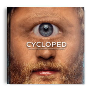 Cycloped